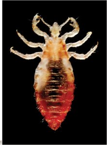 head-louse